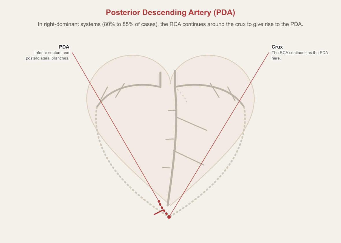 Anterior view of the heart marking the crux, where in right-dominant systems the right coronary artery continues as the posterior descending artery supplying the inferior septum and posterolateral branches.