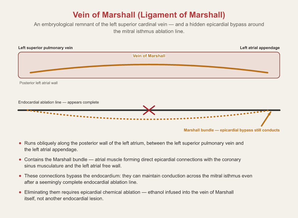 The vein of Marshall running obliquely along the posterior left atrial wall between the left superior pulmonary vein and the left atrial appendage, with a second panel showing the Marshall bundle still conducting epicardially around an endocardial mitral isthmus ablation line that appears complete.